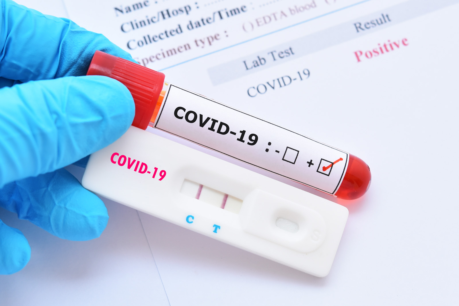 Județul Satu Mare, pe primul loc în tațră în ceea ce privește numărul de infectări cu noul Coronavirus